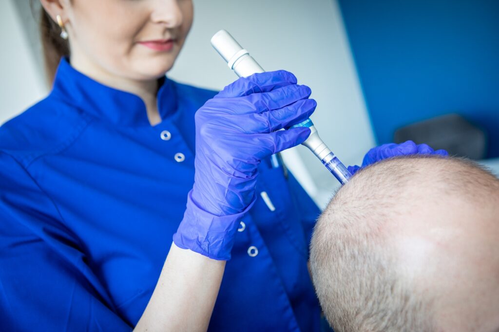 Diagnostyka skóry głowy i łysienia – jak pomaga doświadczony lekarz od włosów